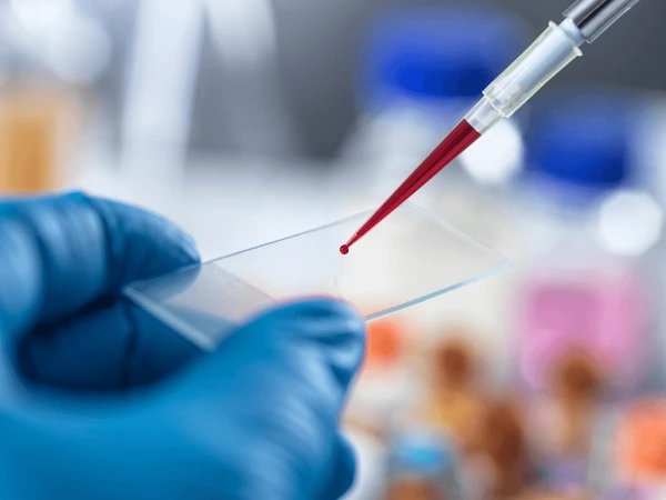 Lab technician dropping blood sample on microscope slide